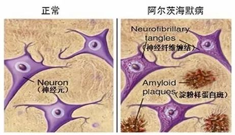 初夏呐段情